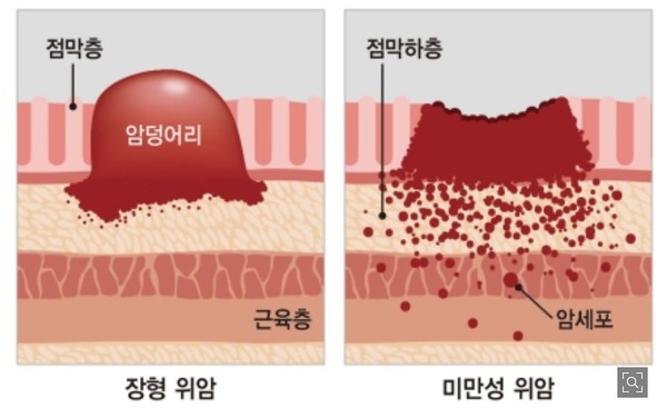   강동경희대병원 홈페이지.