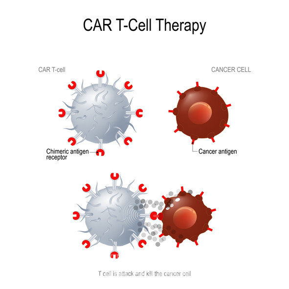 CAR-T 면역세포는 몸 밖에서 강화, 변형돼 강력하게 암과 싸울 수 있게 된다./게티이미지 뱅크