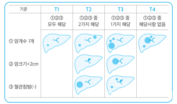 간암을 나누는 병기. /대한간암학회