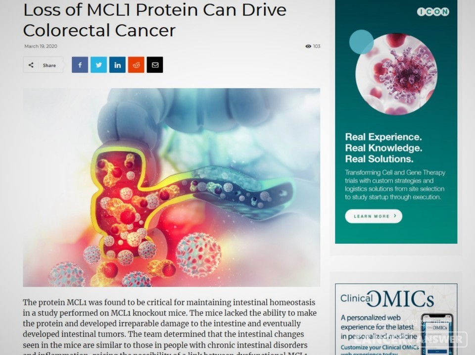 스위스 연구팀이 대장암을 예방할 수 있는 단백질을 발견해 발표했다고 의학저널과 관련 언론들이 밝혔다. / clinical OMICs 캡처