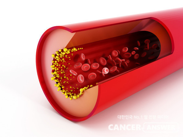 100세 시대를 맞아 혈관·혈액 건강이 핵심 화두로 떠오르고 있다. /게티이미지 뱅크