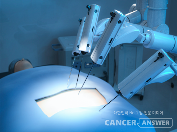수술은 고형암에 가장 우선적으로 사용 되는 치료방법이며 개복 수술, 복강경 수술, 로봇 수술등의 종류가 있다. /게티이미지뱅크