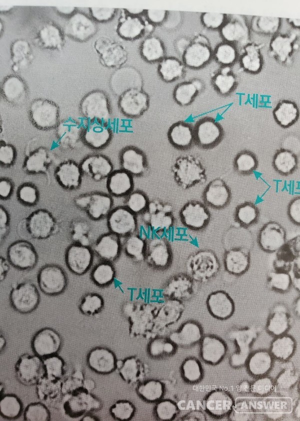 현미경으로 들여다본 백혈구 속의 NK세포, T세포./사진제공=조성훈 교수