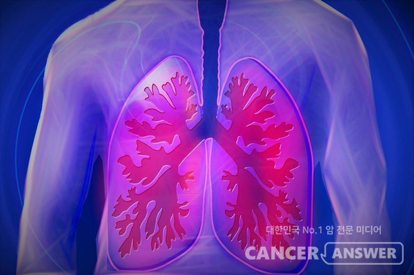 피 한방울이면 30분만에 폐암 판결이 가능한 기술이 국내 연구진에 의해 개발됐다. /게티이미지뱅크.