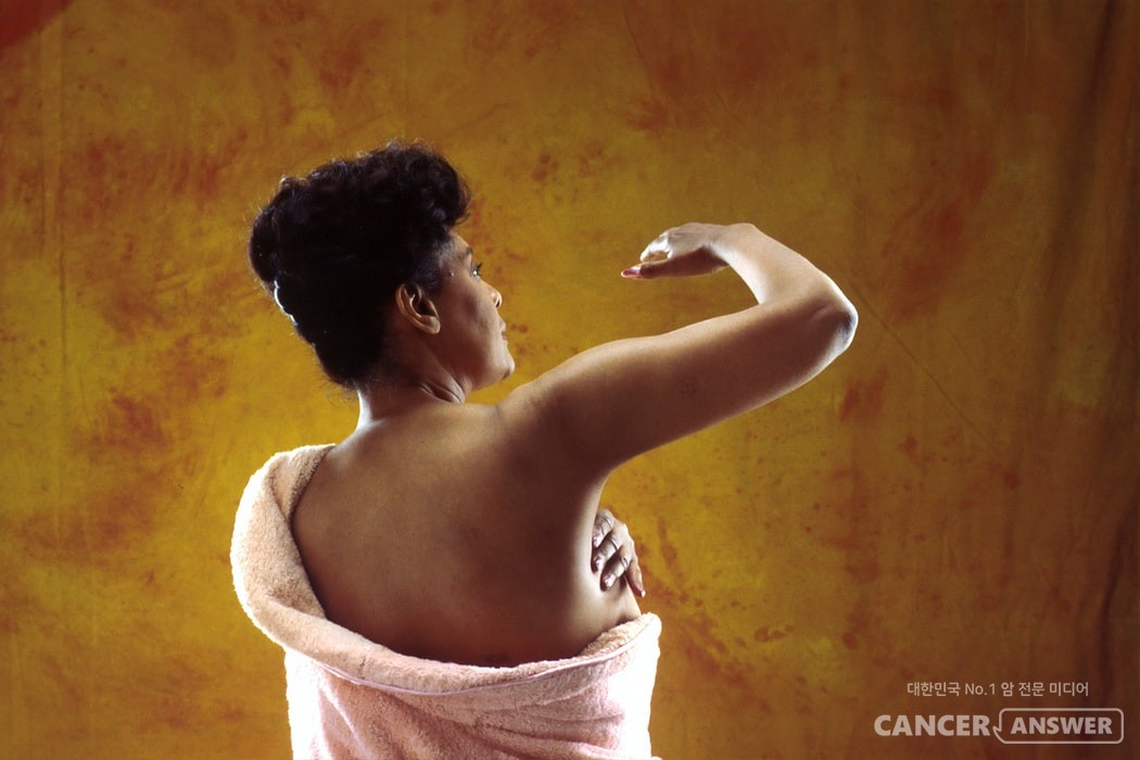 유방암은 크게 소엽암과 유관암으로 나뉘는데, 유관암이 약 80%를 차지한다./Unsplash