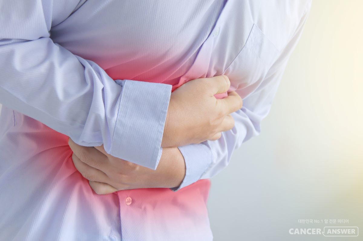 위암의 증상은 꼭 집어 특정하기 어렵지만, 위궤양 비슷한 다양한 증상들이 있다. 초기에는 특별히 암의 증상으로 느끼기 어렵기 때문에 소화불량, 속쓰림 등 소화기 관련 증상이 지속될 경우, 위암검진을 받는 게 좋다. /게티이미지뱅크