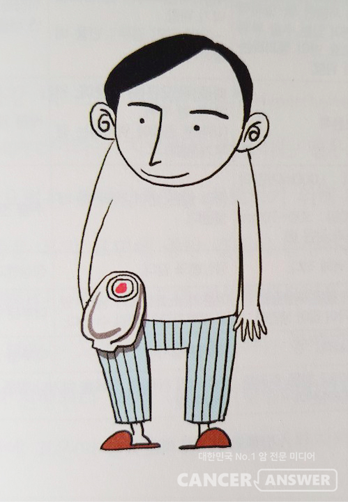 인공장루는 정신적인 두려움을 야기해 환자의 안정적인 사회활동에 영향을 미칠 가능성이 있다./연세대 세브란스병원 '대장암완치설명서' 자료