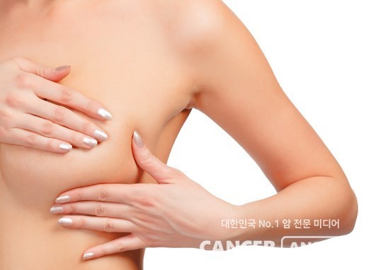 유방암의 12~20%를 차지하는 삼중음성유방암은 암세포에 3가지 수용체가 없어 마땅한 치료제가 없다. /게티이미지 뱅크.