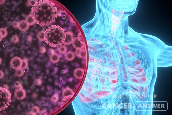 폐렴은 환절기에 유행하는 대표적인 호흡기질환이다. 감기로 오인하기 쉬운데 화농성 가래, 호흡곤란 등이 나타나면 즉시 병원을 찾아야 한다. /게티이미지뱅크