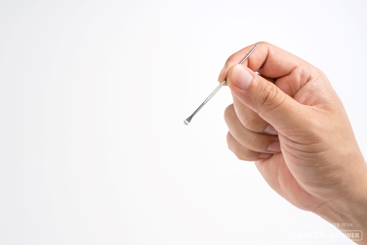 귀지는 귀로 외부에서 이물질이 들어오는 것을 막는 역할을 하기 때문에 억지로 파내면 면역력을 해치는 결과를 초래할 수 있다. / 게티이미지뱅크