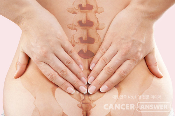 강직성 척추염은 40대 이하 발병률이 높으며, 다른 척추관절 질환과 헷갈리기 쉽다./게티이미지뱅크