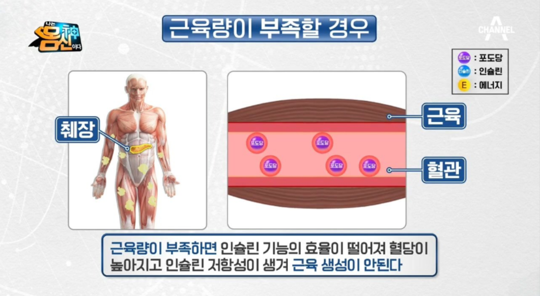 하체근력운동을 하면 당뇨병을 예방할 수 있다는 내용을 방송한 채널A '나는 몸신이다'.