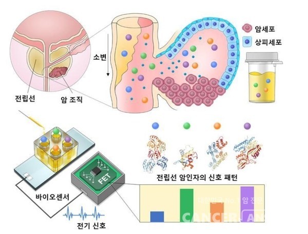 초고감도 바이오센서를 활용하여 환자 소변에서 극미량의 암 인자들을 검출, 여기서 발생하는 검출 신호의 패턴을 얻어내는 모식도./KIST 제공