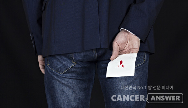 혈뇨는 방광암의 대표적인 증상이다. 통증이 없이 혈뇨가 나오는 경우가 대부분이다. /게티이미지뱅크