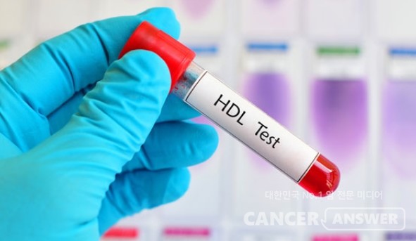 '혈관 청소부' HDL콜레스테롤 혈중수치가 높으면 코로나19 감염 위험이 낮아진다는 연구 결과가 나왔다./게티이미지뱅크