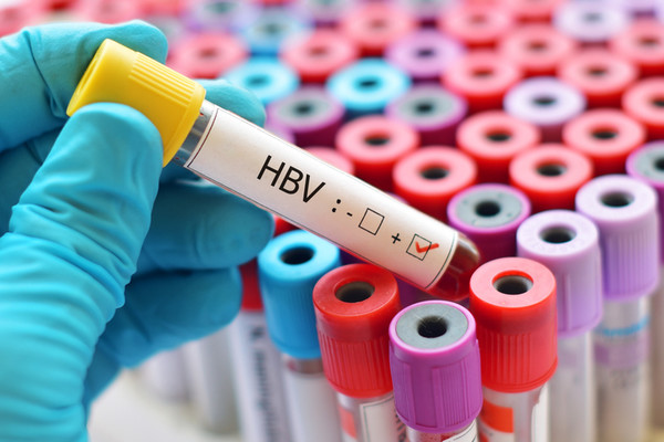 B형간염 보유자는 간 수치가 정상이어도 간암 발병 위험이 높다. B형간염바이러스(HBV) DNA 수치 검사를 통해 정기적으로 간 상태를 체크해야 한다./게티이미지뱅크