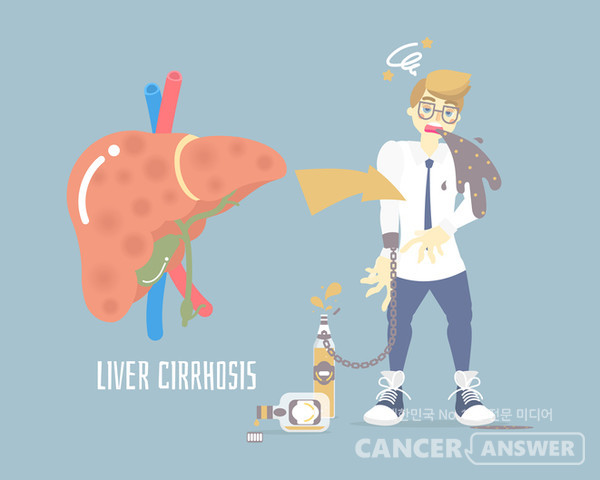 장기간 과도한 음주로 간경변증이 진행되면 술을 끊어도 완전히 회복되기 어렵기 때문에 어느 시점이든 금주하는 것은 필요하다./게티이미지뱅크