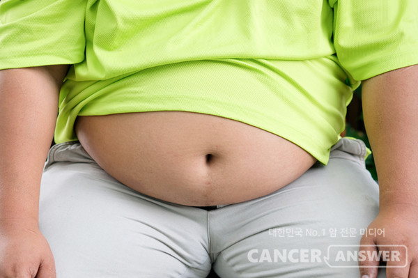 지방간의 대다수는 비만이나 당뇨병, 고지혈증 등이 원인으로 작용하는 비알코올성 지방간이다./게티이미지뱅크