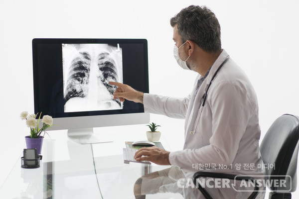 폐암은 발병률 높고 발병 후 5년 생존율이 20.7%로 매우 낮아 치명적인 암으로 꼽힌다./게티이미지뱅크