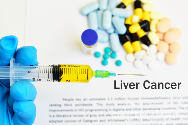 경피적 에탄올 주입술은 가장 오래된 비수술적 치료방법 중의 하나다./게티이미지뱅크