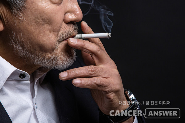 흡연은 폐암의 주요 원인이다. 동남권원자력의학원이 폐암 진단 환자를 조사한 결과, 10명 중 8명이 직간접적인 흡연자라는 사실이 밝혀졌다./게티이미지뱅크
