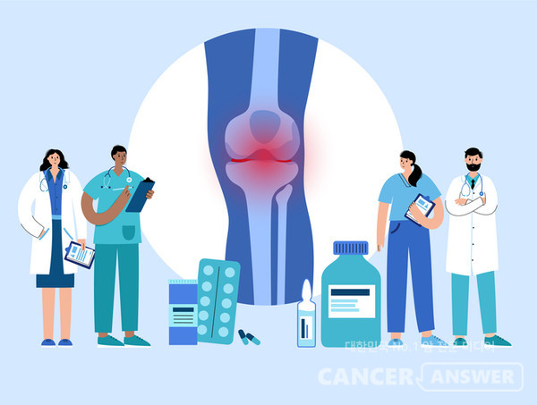 뼈와 연골, 근육 등에 악성종양이 생기는 육종암의 치료방법 중 사지구제술이 있다./게티이미지뱅크