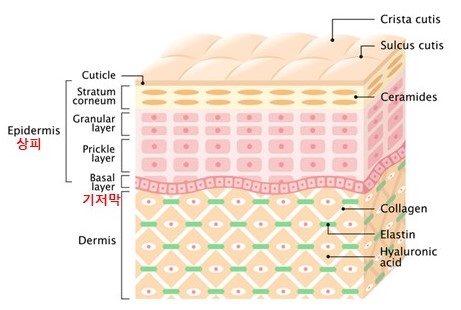 상피내암은 상피에 생긴 암이 기저막을 뚫고 다른 부위로 퍼지지 않은 암이다./게티이미지뱅크
