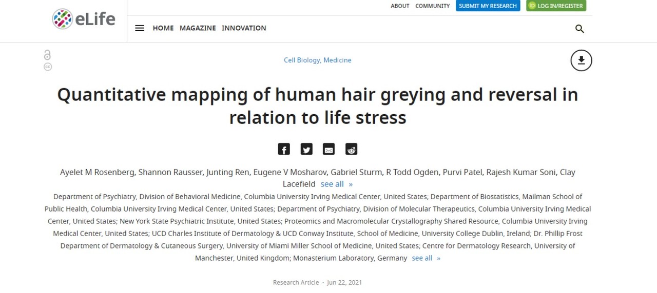 미국 컬럼비아대 연구팀이 스트레스와 머리카락 색의 변화 상관관계를 밝힌 연구 논문을 소개한 '이라이프(elife)' 인터넷판.