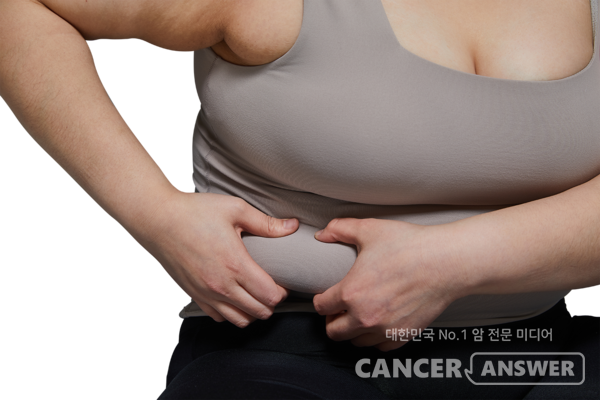 유방암 환자는 비만도가 높고 절대 림프구 수치가 낮을수록 무병생존율이 낮아진다는 연구결과가 나왔다./게티이미지뱅크 