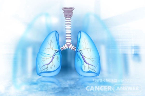 한의학적 관점에서 보면 폐암은 간화(감정적인 분노)가 지속되고, 이 분노를 풀어내지 못해 생깁니다./게티이미지뱅크