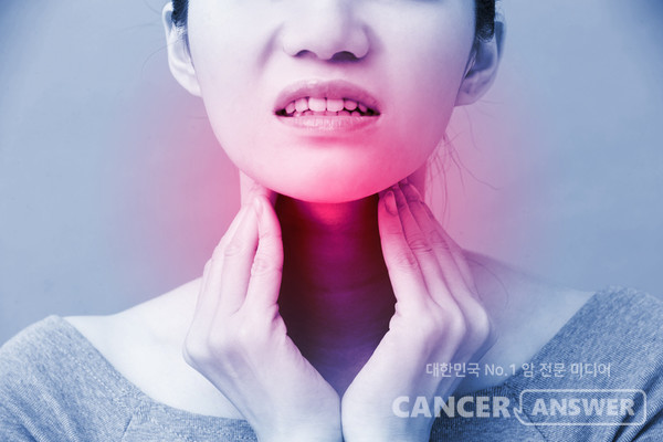 갑상선암 재발을 막기 위해 실시하는 갑상선자극호르몬 억제 요법이 심혈관 질환 발생 위험을 높인다는 연구 결과가 발표됐다. /게티이미지뱅크