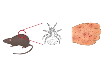 야생쥐에 기생하는 진드기가 사람을 물면 쯔쯔가무시병에 걸릴 수 있어 벌초 등 야외활동 때 주의해야 한다. / 서울아산병원