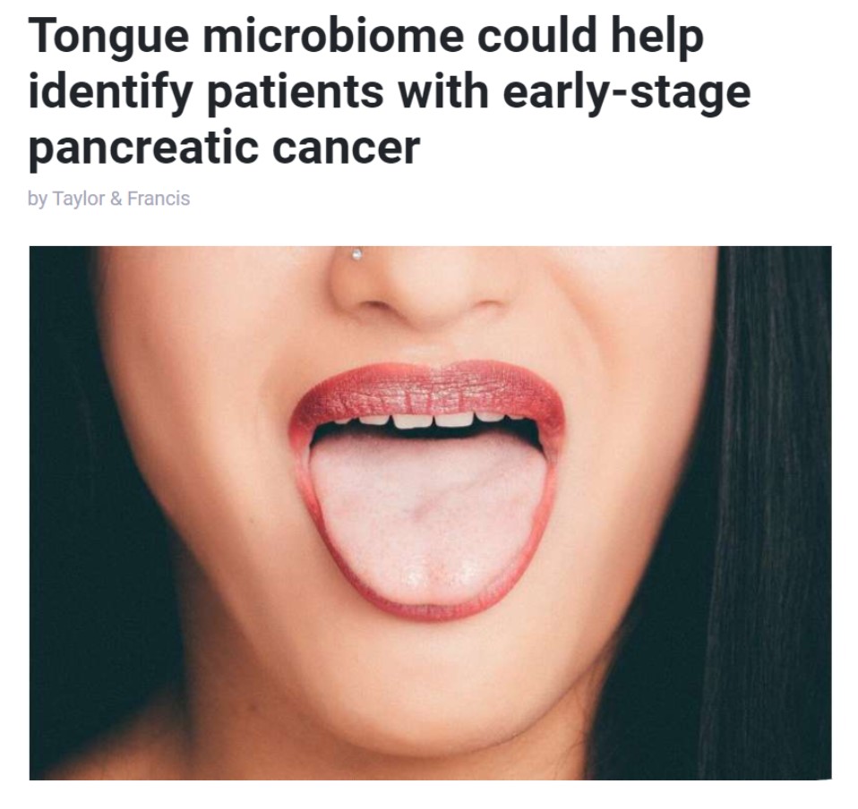 조기 진단이 어려운 췌장암을 혀의 미생물을 분석해 진단할 수 있다는 연구결과를 소개한 영국 매체 'Medical Xpress'.