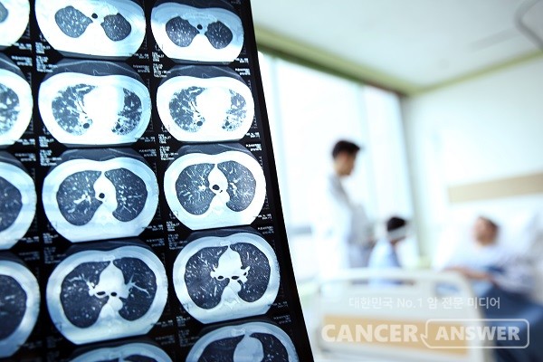 대한암학회가 암 치료의 올바른 선택 4가지를 알려주는 캠페인을 벌인다./게티이미지뱅크