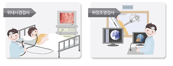 위내시경과 위장조영검사가 각기 어떻게 다른지 알아본다. /출처 국가암정보센터