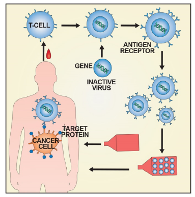 CAR-T 의 제조 및 투여과정. 1단계=single chain Fv(scFv) 전이 유전자 포함된 벡터 제조. 2단계=T 세포에 벡터 도입. 3단계=키메릭 항원 수용체 유전자 도입된 T 세포 증식 및 투여. / 자료 보건복지부