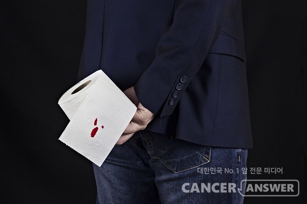 날씨가 추운 겨울에는 치핵을 더욱 조심해야 한다./게티이미지뱅크