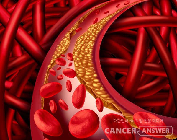20, 30대 젊은 남성은 이상지질혈증을 특히 조심해야 한다./게티이미지뱅크