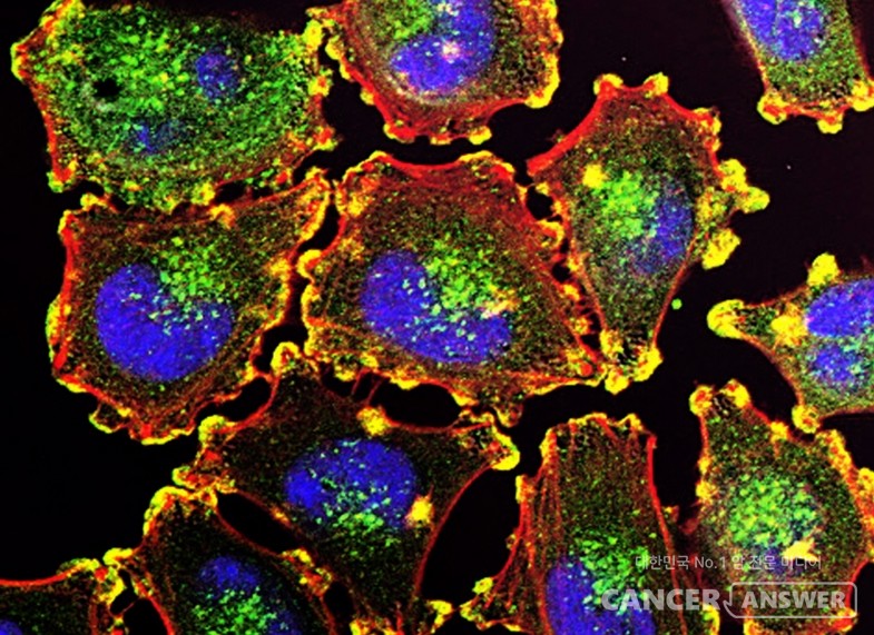 돌연변이의 결과로 생긴 암세포를 정상세포로 되돌릴 수 있다는 것이 밝혀져 암 치료의 새로운 가능성이 제기됐다. 사진은 전이성 흑색종 세포. / unsplash