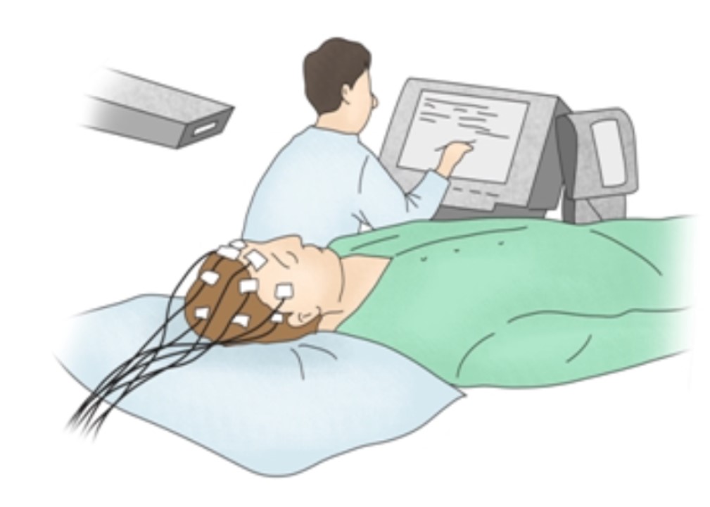 뇌전증을 진단하기 위해 실시하는 뇌파검사. / 서울아산병원