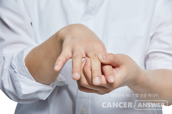 손가락과 손목 류마티스관절염을 앓는 사람이 많다./게티이미지뱅크
