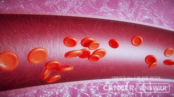 만성질환이 있는 사람은 경동맥협착증을 더욱 주의해야 한다/게티이미지뱅크