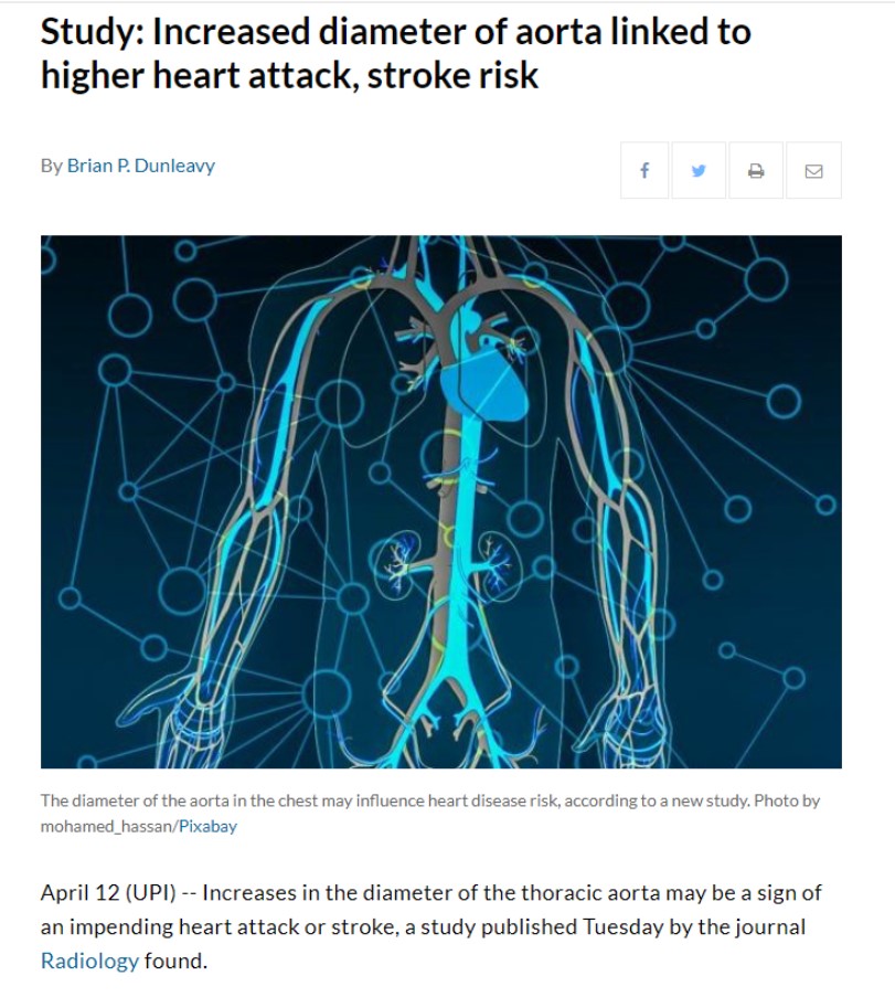 UPI를 비롯한 해외언론들이 흉부 대동맥의 확장이 갖는 위험성에 대한 연구결과를 보도했다.