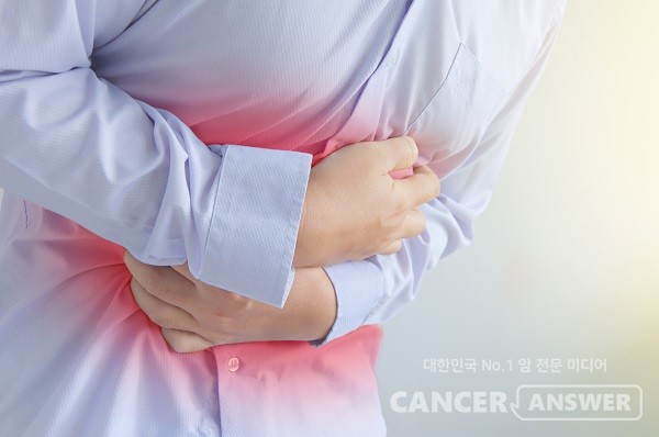미만형 위암은 덩어리를 만드는 장형 위암과 달리 위 점막 아래로 퍼지는 특징을 갖는다./게티이미지뱅크
