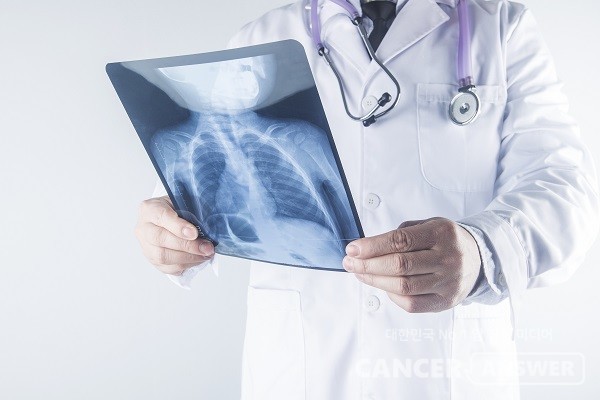 암 치료 방법 중 저분할 방사선 치료가 눈길을 끈다./게티이미지뱅크