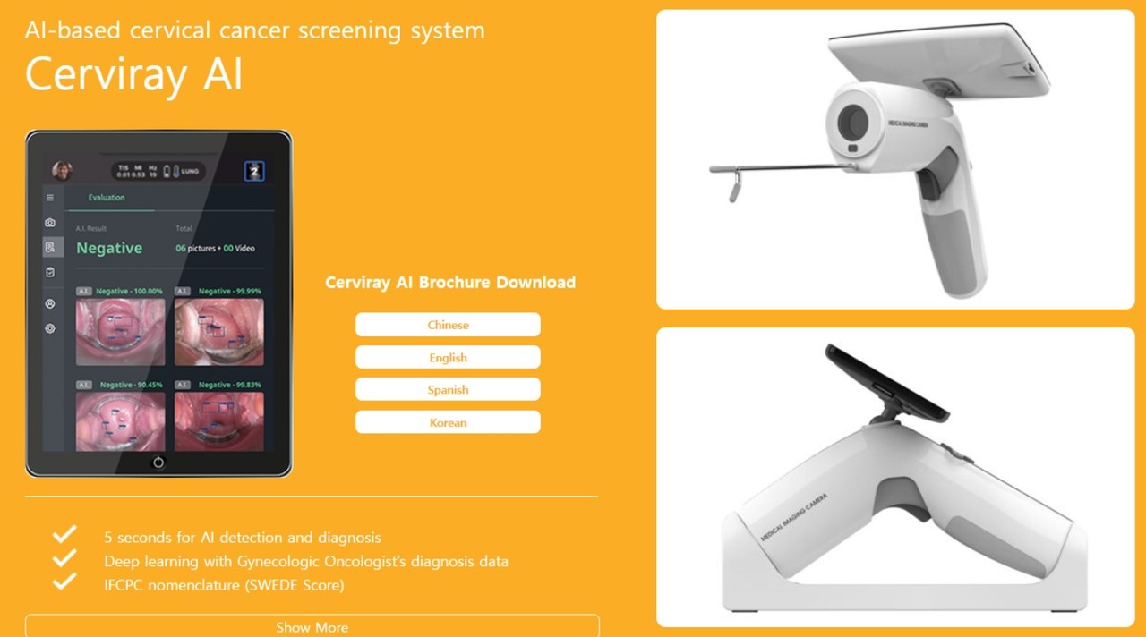 AI기반 의료기업인 아이도트가 2024년까지 갑상샘암 재발 예측 프로그램을 만들겠다고 선언했다. 사진은 아이도트의 자궁경부암 인공지능 진단 시스템 ‘써비레이AI’ .