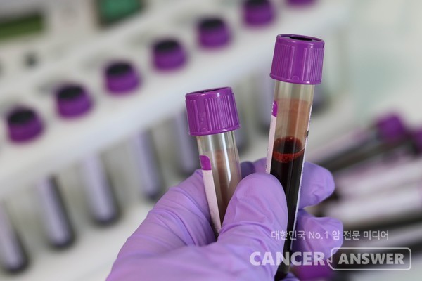 피 한방울로 현장에서 곧바로 암 같은 질환을 찾아낼 수 있는 바이오센서가 개발됐다. /픽사베이