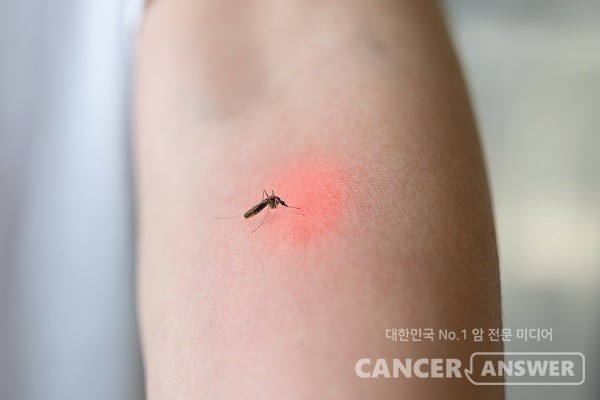 여름철에는 말라리아를 조심해야 한다./게티이미지뱅크