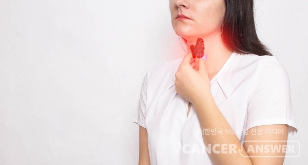 갑상선암 호르몬제 복용 시 주의할 점을 알아둬야 한다./게티이미지뱅크