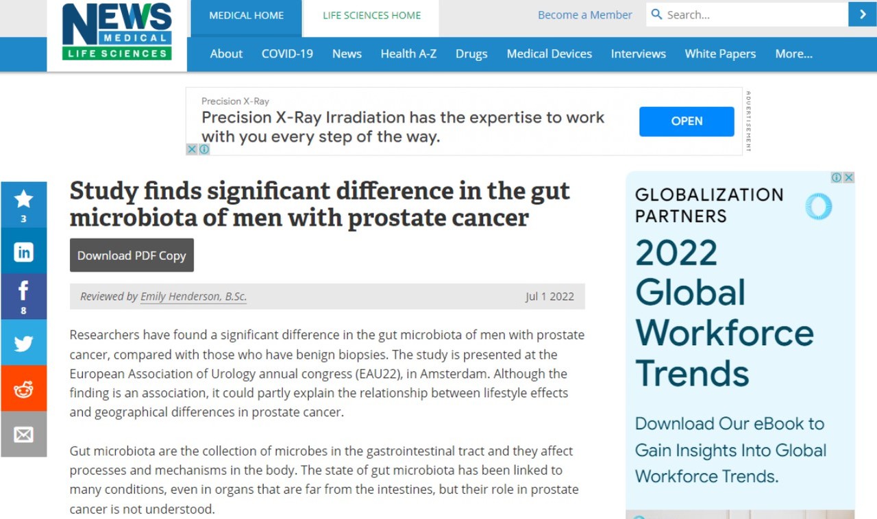 전립선암 환자의 장내 생태계가 일반인과 다르다는 연구결과를 소개한 'News-Medical Life Science'.